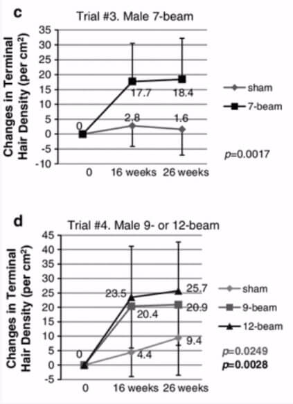 תוצאות הניסוי של הצמחת שיער בלייזר קר LLLT על גברים