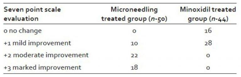 תוצאות מחקר של מינוקסידיל מול דרמה רולר בטבלה