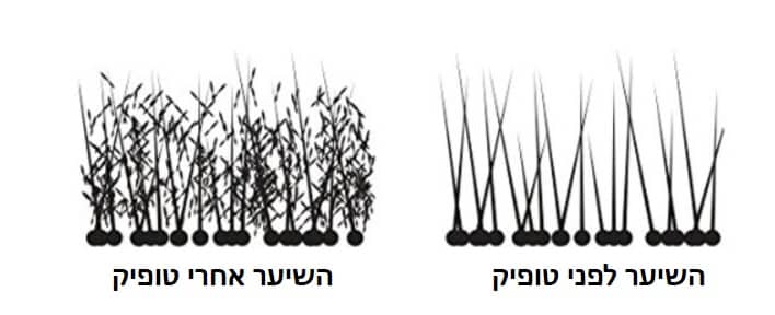 תמונה שממחישה איך הטופיק מתחבר לשיער