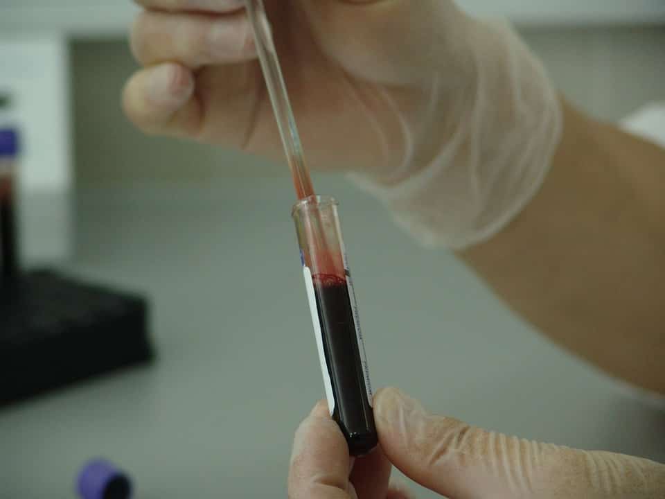 מבחנה של בדיקת דם במעבדה