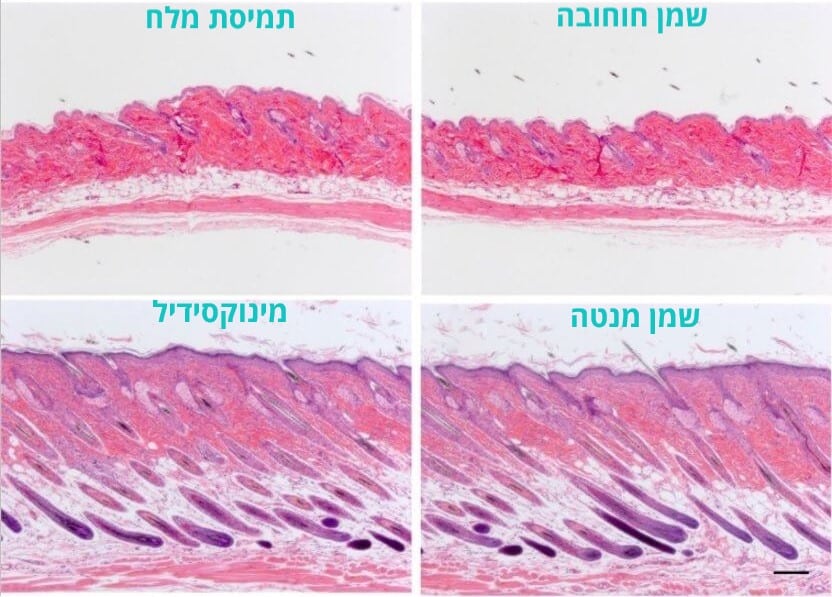 תקריב היסטולוגי על העור של העכברים מהניסוי עם שמן מנטה