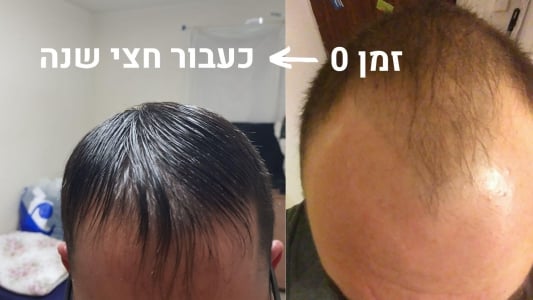 לפני ואחרי חצי שנה של שימוש ב-HR Growth