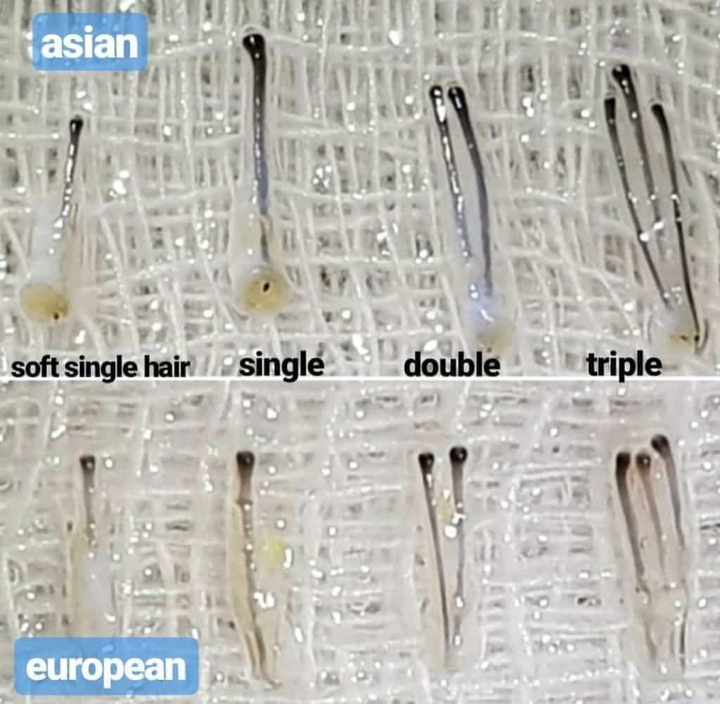 סוגים שונים של זקיקי שיער