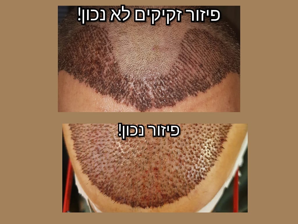 פיזור זקיקים מזעזע ושגוי על לקוח שרצה לחסוך כמה דולרים