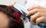 מסרק לייזר לנשירת שיער: טיפול מהפכני או צעצוע מיותר?